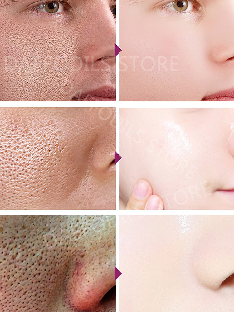 Sérum de redução de poros Facial