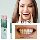 Caneta Clareia Já - Dentes Brancos e Brilhantes- PROMOÇÃO da Semana | FRETE GRÁTIS | COMPRE 1 LEVE 2