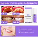 Clareador Dental V34® - Seu sorrio perfeito - COMPRE 1 E LEVE 2