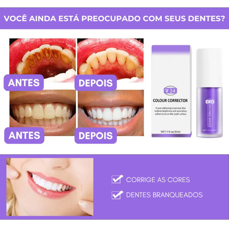 Clareador Dental V34® - Seu sorrio perfeito - COMPRE 1 E LEVE 2